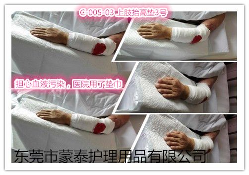 蒙泰护理C-005-03上肢抬高垫3号临床使用组图