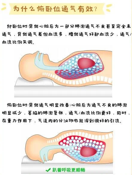 眼科趴枕